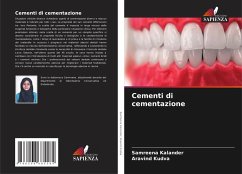 Cementi di cementazione Cover Cementi di cementazione