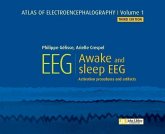 Atlas of electroencephalography - Volume 1 : Awake and sleep EEG. 3ED (eBook, ePUB) Atlas of electroencephalography - Volume 1 : Awake and sleep EEG. 3ED (eBook, ePUB)