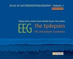 Atlas of electroencephalography Volume 2 : The Epilepsies. 2ED (eBook, ePUB) Atlas of electroencephalography Volume 2 : The Epilepsies. 2ED (eBook, ePUB)