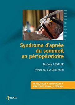 Syndrome d'apnée du sommeil en périopératoire (eBook, ePUB) - Liotier, Jérôme Syndrome d'apnée du sommeil en périopératoire (eBook, ePUB) - Liotier, Jérôme