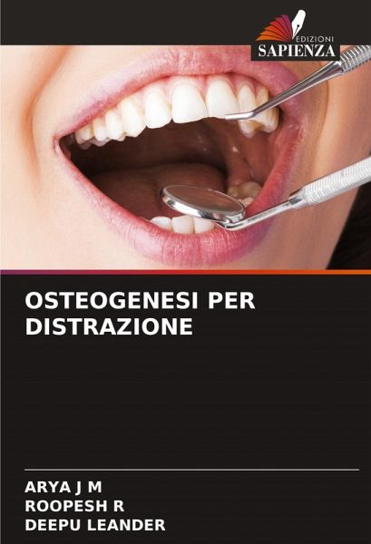 OSTEOGENESI PER DISTRAZIONE OSTEOGENESI PER DISTRAZIONE