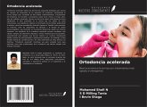 Ortodoncia acelerada