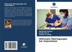 Okklusale Überlegungen bei Implantaten