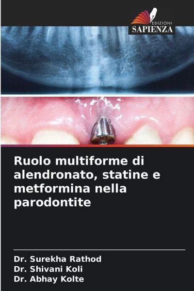 Ruolo multiforme di alendronato, statine e metformina nella parodontite