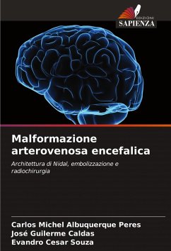 Malformazione arterovenosa encefalica - Albuquerque Peres, Carlos Michel;Caldas, José Guilerme;Souza, Evandro Cesar