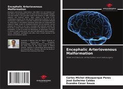 Encephalic Arteriovenous Malformation - Albuquerque Peres, Carlos Michel;Caldas, José Guilerme;Souza, Evandro Cesar