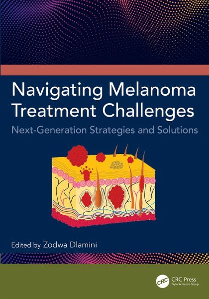 Navigating Melanoma Treatment Challenges (eBook, ePUB) Navigating Melanoma Treatment Challenges (eBook, ePUB)