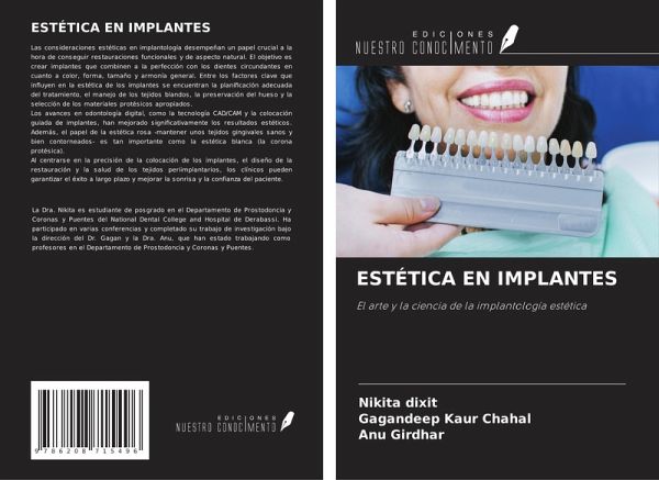 ESTÉTICA EN IMPLANTES