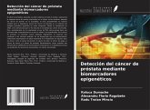 Detección del cáncer de próstata mediante biomarcadores epigenéticos Detección del cáncer de próstata mediante biomarcadores epigenéticos