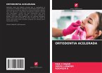 ORTODONTIA ACELERADA
