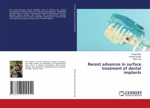 Recent advances in surface treatment of dental implants