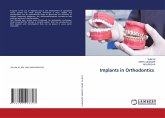 Implants in Orthodontics Implants in Orthodontics