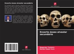 Enxerto ósseo alveolar secundário - Tanneru, Nagaraju;Vura, Nanda Gopal