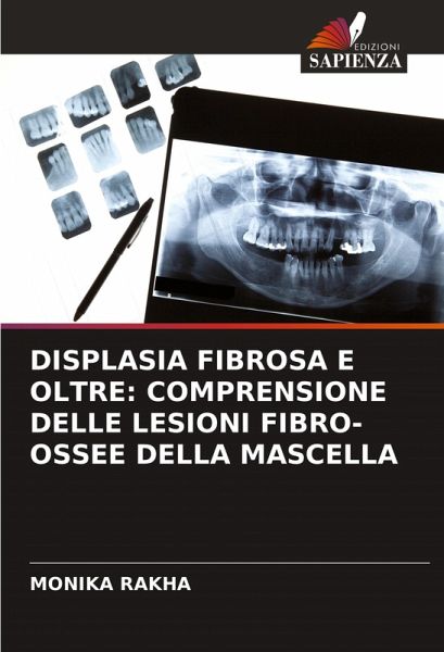 DISPLASIA FIBROSA E OLTRE: COMPRENSIONE DELLE LESIONI FIBRO-OSSEE DELLA MASCELLA