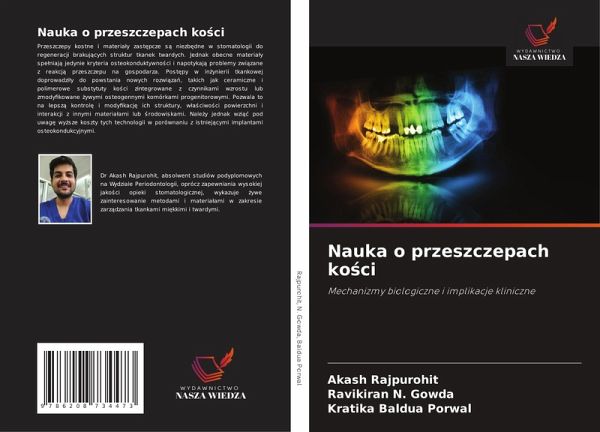 Nauka o przeszczepach ko¿ci Nauka o przeszczepach ko¿ci