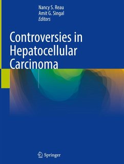 Cover Controversies in Hepatocellular Carcinoma