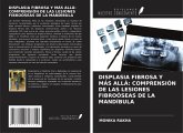 DISPLASIA FIBROSA Y MÁS ALLÁ: COMPRENSIÓN DE LAS LESIONES FIBROÓSEAS DE LA MANDÍBULA DISPLASIA FIBROSA Y MÁS ALLÁ: COMPRENSIÓN DE LAS LESIONES FIBROÓSEAS DE LA MANDÍBULA