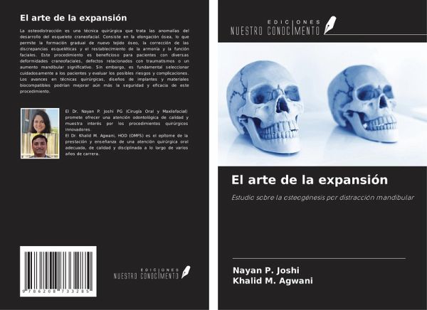 El arte de la expansión