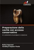 Preparazione della cavità con accesso conservativo Preparazione della cavità con accesso conservativo