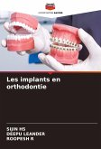 Les implants en orthodontie Les implants en orthodontie