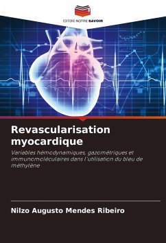 Cover Revascularisation myocardique