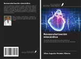 Revascularización miocárdica