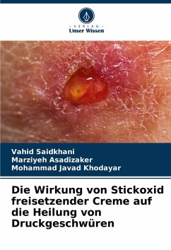 Cover Die Wirkung von Stickoxid freisetzender Creme auf die Heilung von Druckgeschwüren