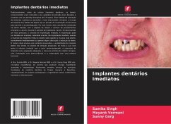Cover Implantes dentários imediatos
