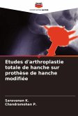 Etudes d'arthroplastie totale de hanche sur prothèse de hanche modifiée Etudes d'arthroplastie totale de hanche sur prothèse de hanche modifiée