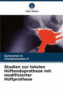 Cover Studien zur totalen Hüftendoprothese mit modifizierter Hüftprothese