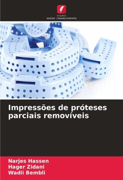 Cover Impressões de próteses parciais removíveis
