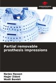 Partial removable prosthesis impressions Partial removable prosthesis impressions