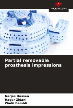 Cover Partial removable prosthesis impressions