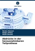 Abdrücke in der herausnehmbaren Teilprothese Abdrücke in der herausnehmbaren Teilprothese