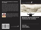 Bloqueo paravertebral en fracturas de costillas Bloqueo paravertebral en fracturas de costillas