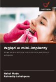 Wgl¿d w mini-implanty Wgl¿d w mini-implanty