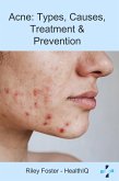 Acne: Types, Causes, Treatment & Prevention (eBook, ePUB) Acne: Types, Causes, Treatment & Prevention (eBook, ePUB)