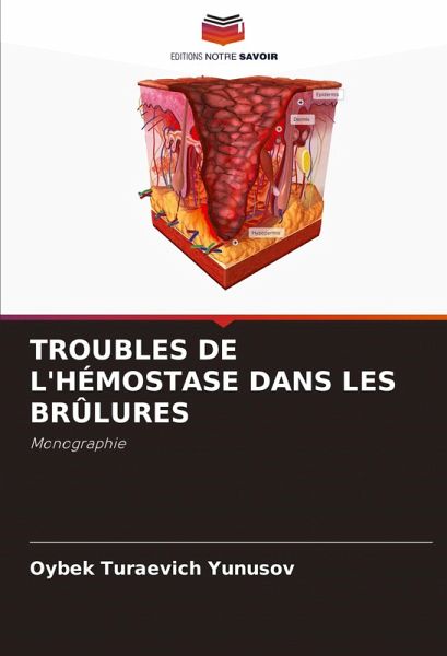 TROUBLES DE L'HÉMOSTASE DANS LES BRÛLURES TROUBLES DE L'HÉMOSTASE DANS LES BRÛLURES