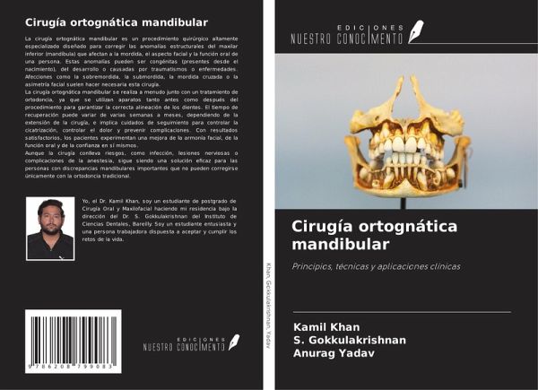 Cirugía ortognática mandibular