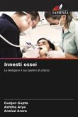 Innesti ossei Innesti ossei
