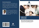 Knochenimplantate Knochenimplantate