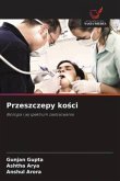 Przeszczepy ko¿ci Przeszczepy ko¿ci