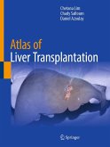 Atlas of Liver Transplantation (eBook, PDF) Atlas of Liver Transplantation (eBook, PDF)