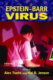 Epstein-Barr Virus (eBook, ePUB)