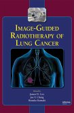 Image-Guided Radiotherapy of Lung Cancer (eBook, ePUB)