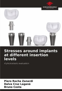 Stresses around implants at different insertion levels - Rocha Zanardi, Piero;Cruz Laganá, Dalva;Costa, Bruno