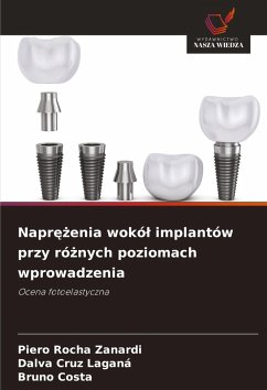 Cover Napr¿¿enia wokó¿ implantów przy ró¿nych poziomach wprowadzenia