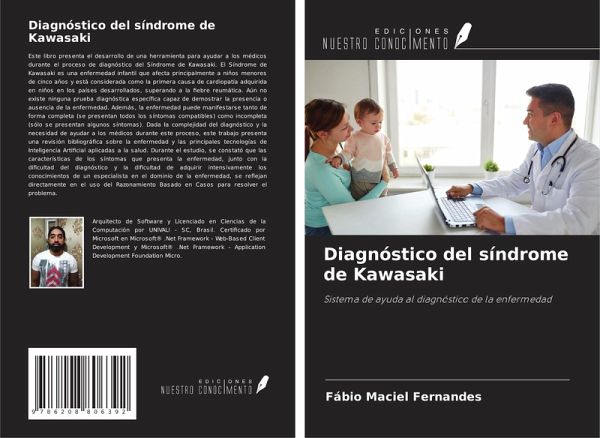 Diagnóstico del síndrome de Kawasaki