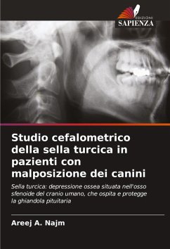 Cover Studio cefalometrico della sella turcica in pazienti con malposizione dei canini