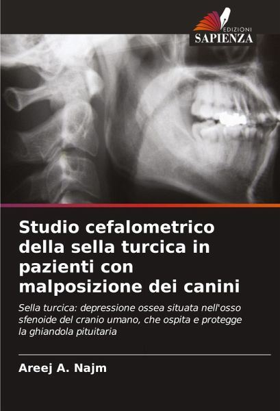 Studio cefalometrico della sella turcica in pazienti con malposizione dei canini Studio cefalometrico della sella turcica in pazienti con malposizione dei canini